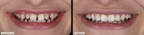 aesthetic dentistry near you