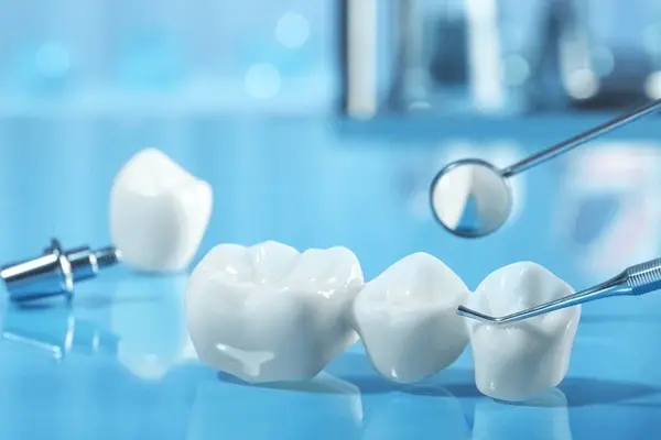 dental bridges in nw calgary