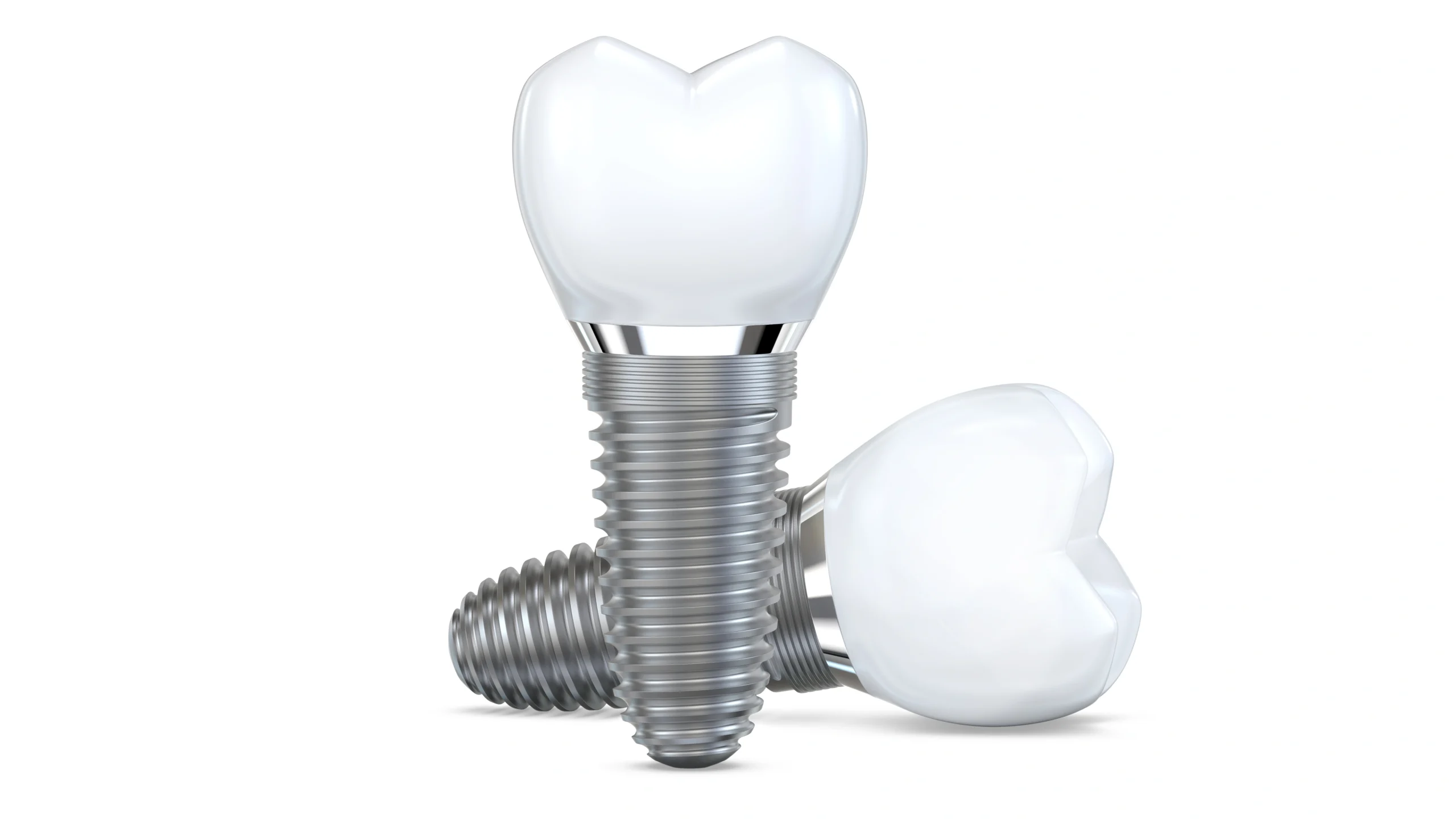 dental implants near you