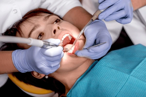 dental sealants in nw calgary