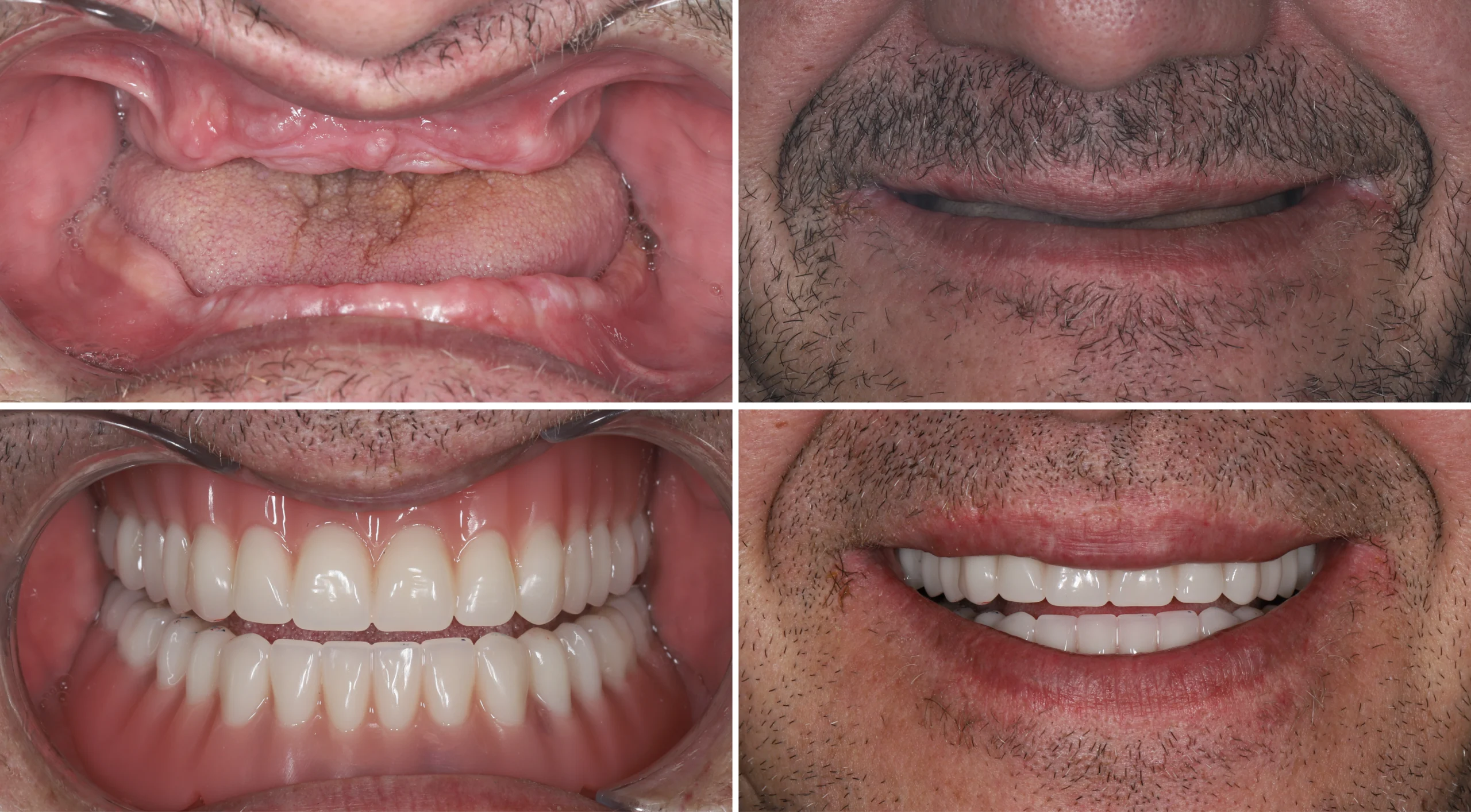 full mouth transformation in nw calgary