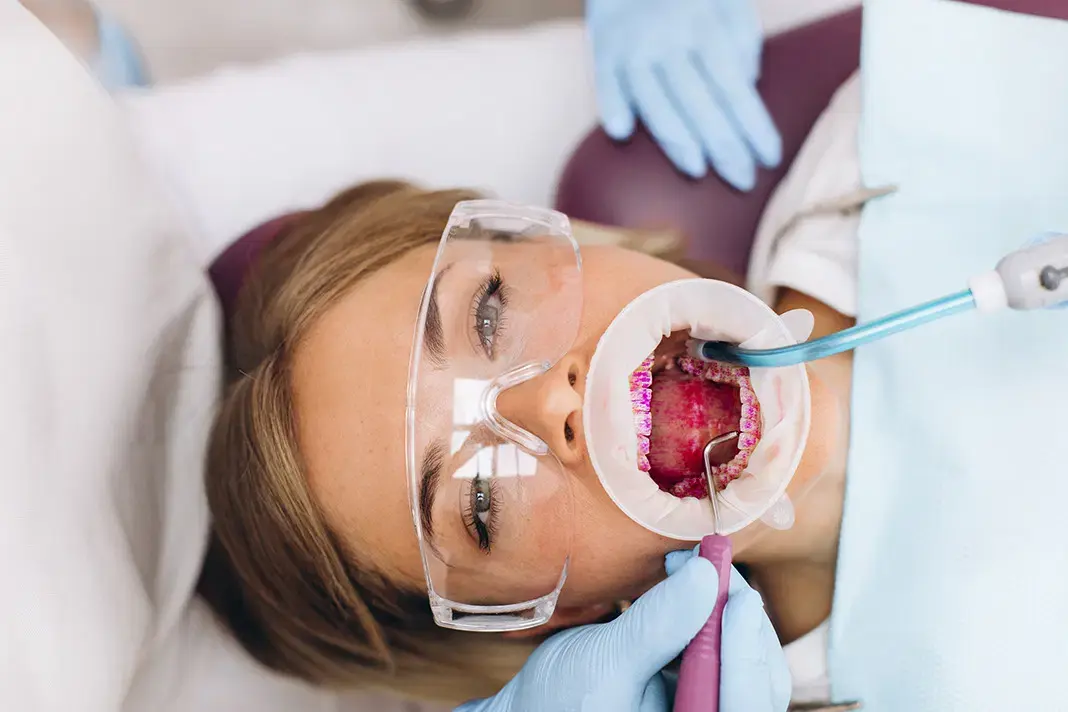 guided biofilm therapy in nw calgary