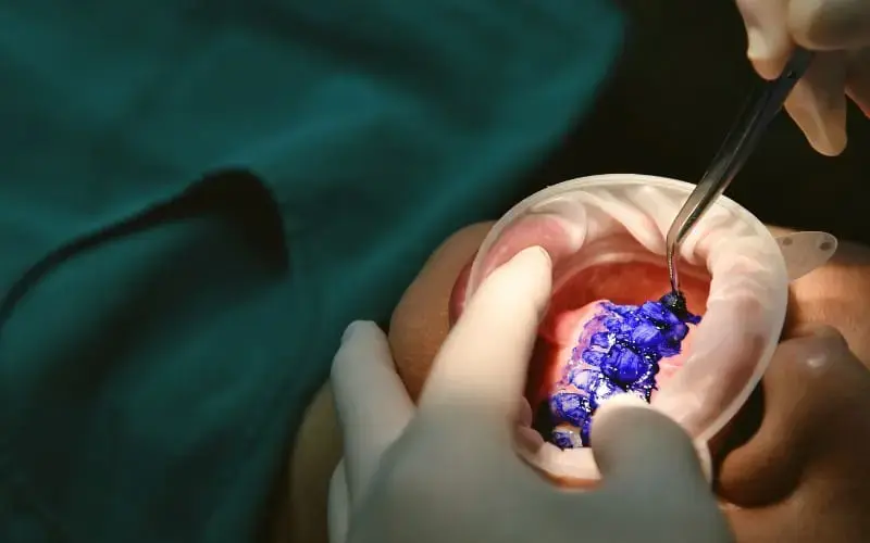 guided biofilm therapy near you