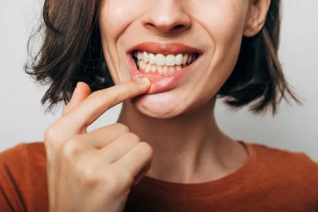 gum disease treatment in nw calgary