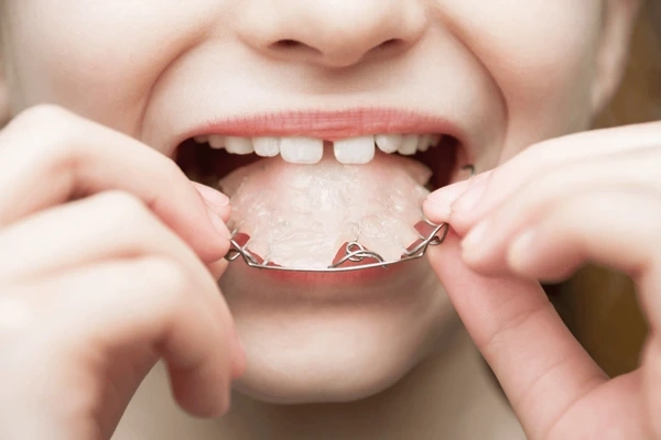 invisalign near you