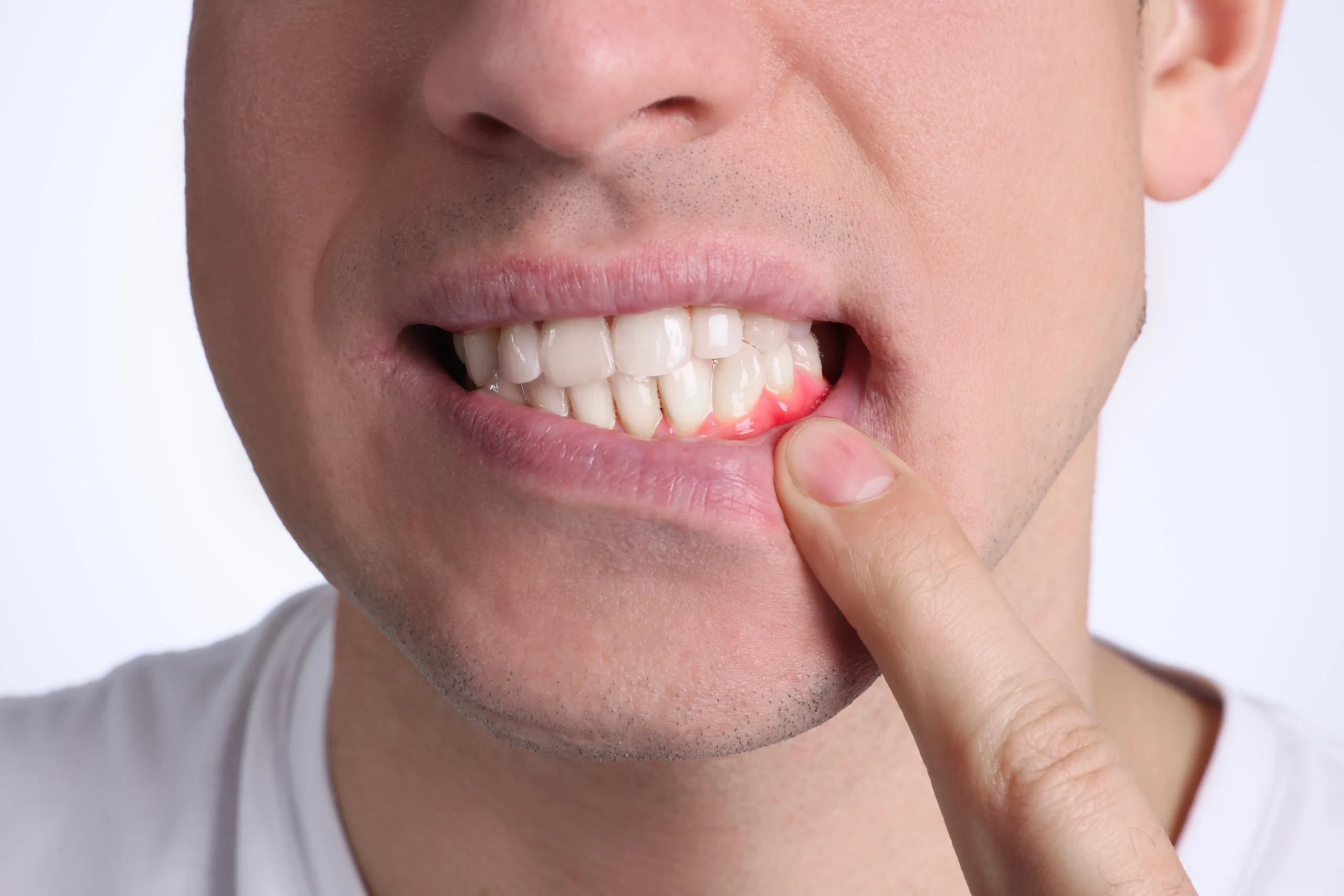 periodontal dentistry near you