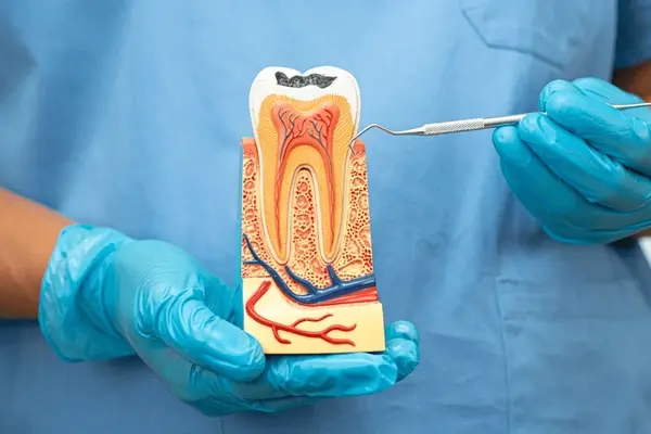 root canal therapy near you