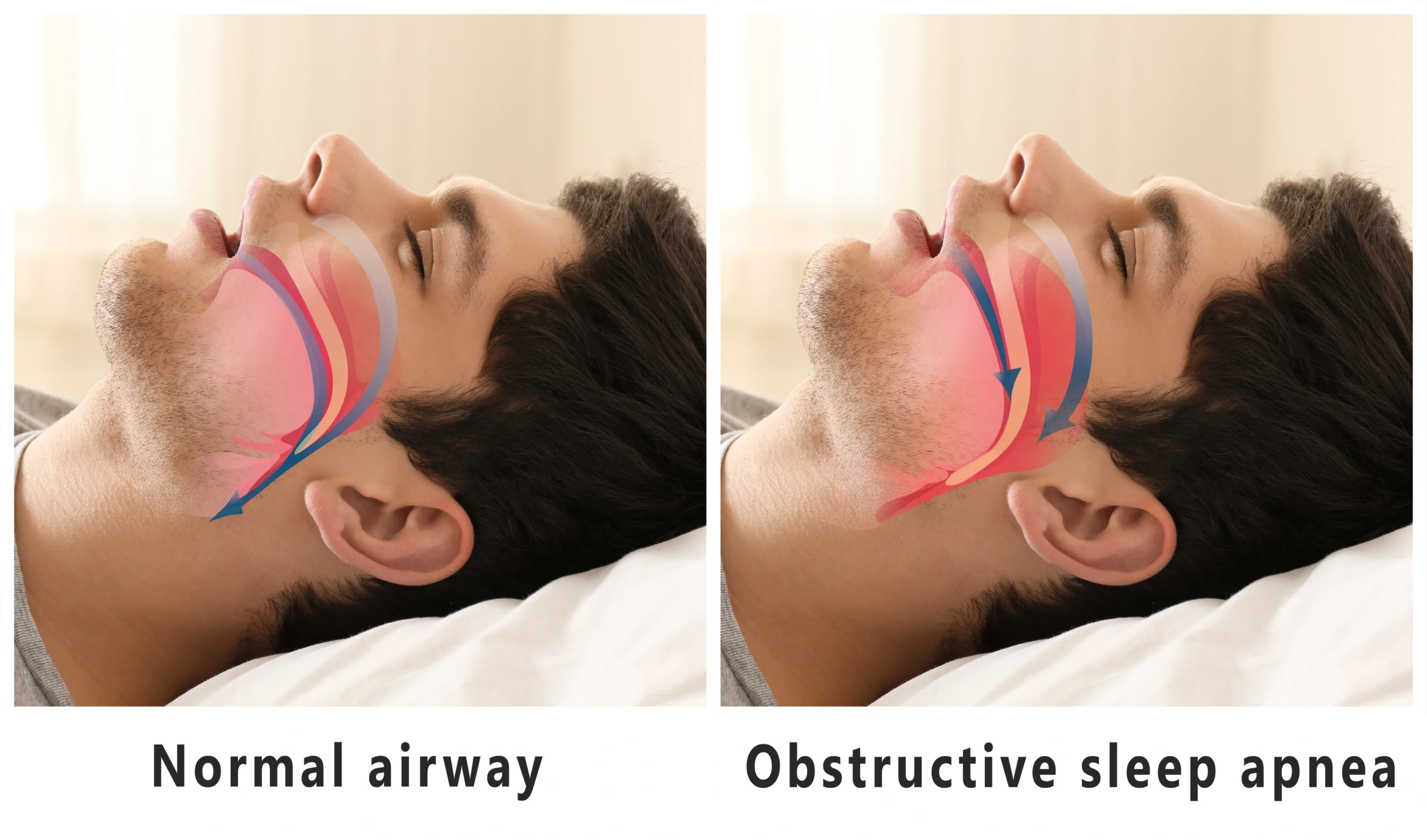 tmj, sleep and airway care in nw calgary